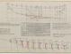 PLAN DE CONSTRUCTION - MOTOR SAILER DE 12 m (1958)