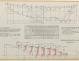 PLAN DE DERIVE/QUILLE - PATRICIA III CRUISER Hte mer 13 m  (1962)