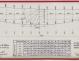 PLAN DE CONSTRUCTION - WINDJAMMER  12,20 M (1962)