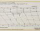 PLAN DE DERIVE/QUILLE - Grand Large  (1975)