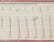 PLAN DE DERIVE/QUILLE - K.M. 1200 (1978)