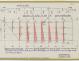 PLAN DE DERIVE/QUILLE - ESTURGEON 10,50 M (1981)